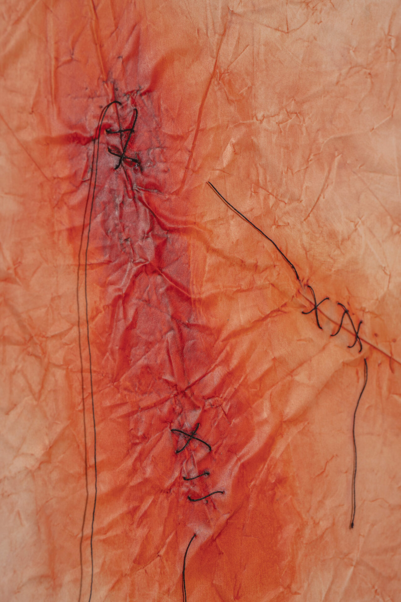 Heidi-Barkun_Tis-but-a-flesh-wound-III_2008_detail